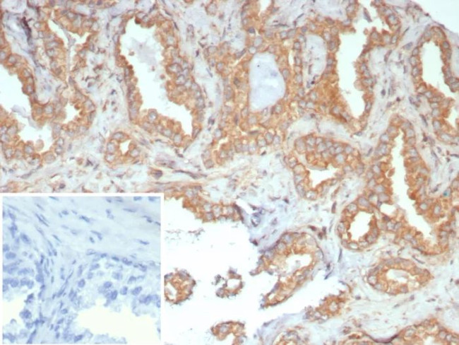 RET Proto-oncogene Antibody in Immunohistochemistry (Paraffin) (IHC (P))