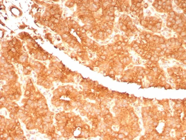 RET Proto-oncogene Antibody in Immunohistochemistry (Paraffin) (IHC (P))