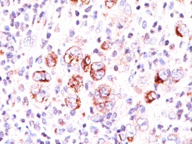 Bcl-X (Apoptosis Marker) Antibody in Immunohistochemistry (Paraffin) (IHC (P))