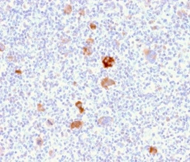 Bcl-X (Apoptosis Marker) Antibody in Immunohistochemistry (Paraffin) (IHC (P))