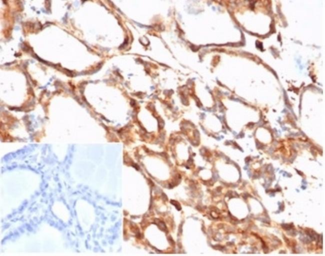 Beta-Actin (ACTB) Antibody in Immunohistochemistry (Paraffin) (IHC (P))