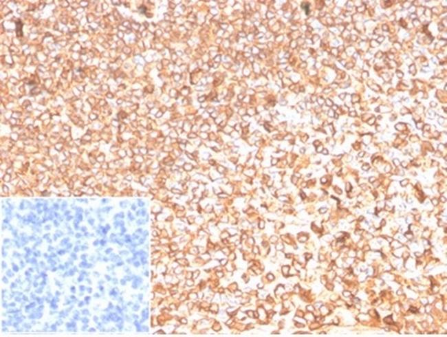 Beta-Actin (ACTB) Antibody in Immunohistochemistry (Paraffin) (IHC (P))