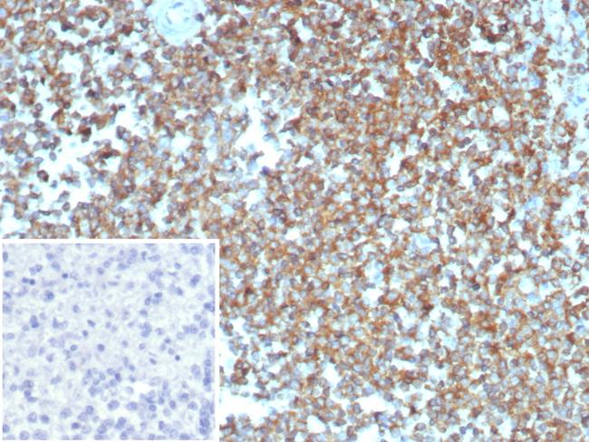 beta-Actin (ACTB) Antibody in Immunohistochemistry (Paraffin) (IHC (P))