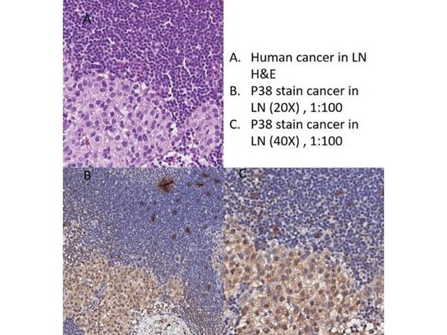 P38 Antibody in Immunohistochemistry (IHC)