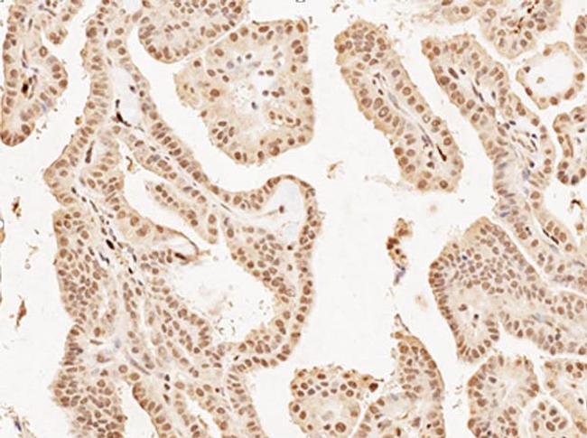 Mash1/Ascl1 Antibody in Immunohistochemistry (IHC)