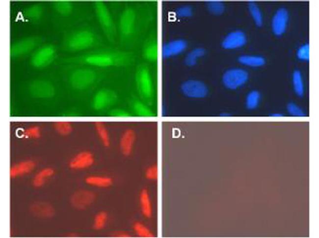 Telomerase catalytic subunit Antibody in Immunocytochemistry (ICC/IF)