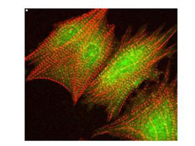 Phospho-AKT (Ser473) Antibody in Immunocytochemistry (ICC/IF)