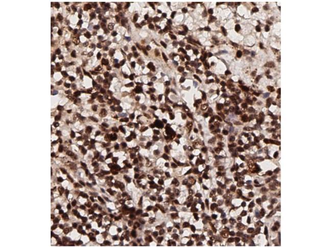 Phospho-AKT (Thr308) Antibody in Immunohistochemistry (IHC)