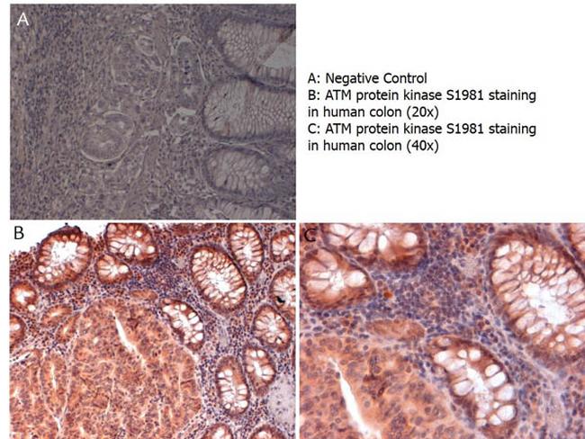 Phospho-ATM Protein Kinase (Ser1981) Antibody in Immunohistochemistry (Paraffin) (IHC (P))