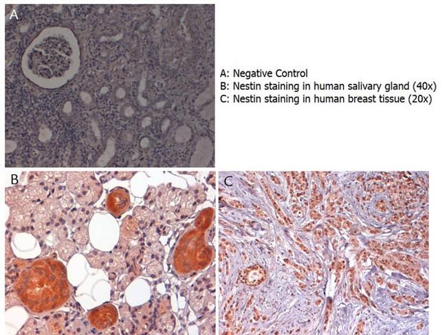 Nestin Antibody in Immunohistochemistry (Paraffin) (IHC (P))