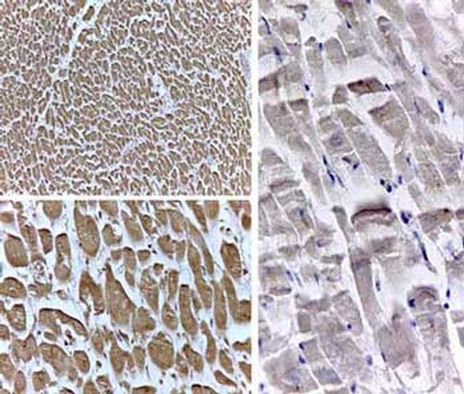 PPAR Delta Antibody in Immunohistochemistry (IHC)