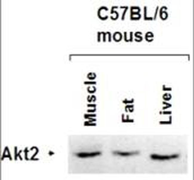 AKT2 Antibody in Western Blot (WB)