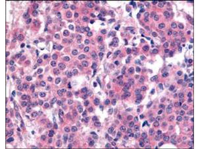 Phospho-PLK1 (Thr210) Antibody in Immunohistochemistry (Paraffin) (IHC (P))