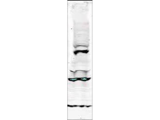 Tlk1 Antibody in Western Blot (WB)