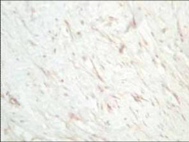 SFRP1 Antibody in Immunohistochemistry (IHC)