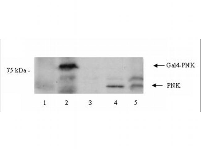 PNK Antibody in Western Blot (WB)