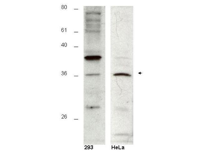 HUS1B Antibody in Western Blot (WB)