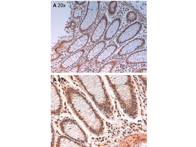 Phospho-Aurora Kinase B (Thr232) Antibody in Immunohistochemistry (Paraffin) (IHC (P))