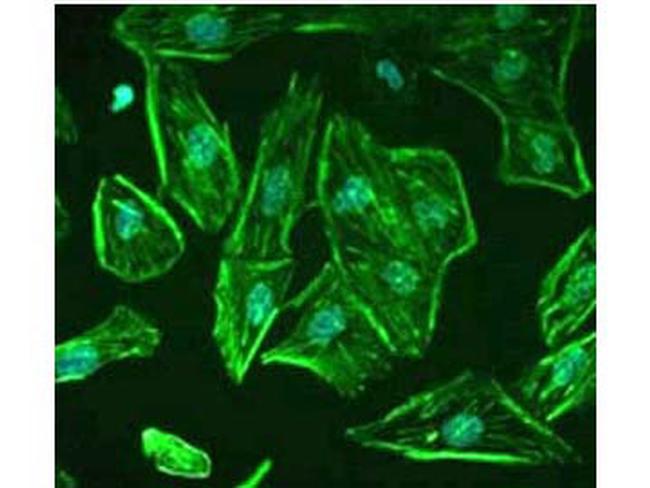 ROBO-1 Antibody in Immunocytochemistry (ICC/IF)