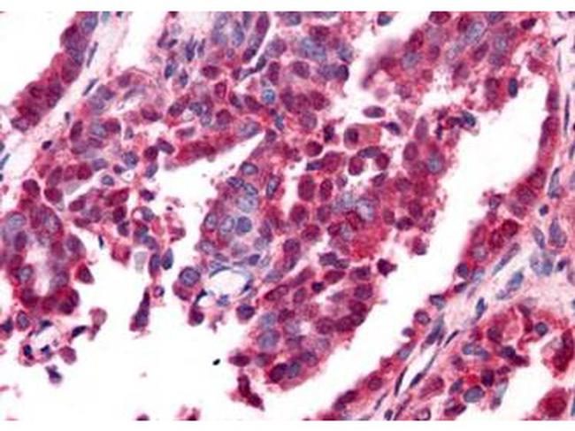 EGR-1 Antibody in Immunohistochemistry (Paraffin) (IHC (P))