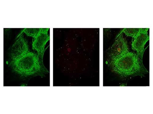 GLI3 Antibody in Immunocytochemistry (ICC/IF)