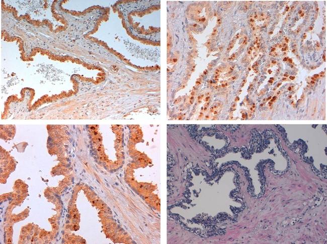 SLIT2 Antibody in Immunohistochemistry (Paraffin) (IHC (P))