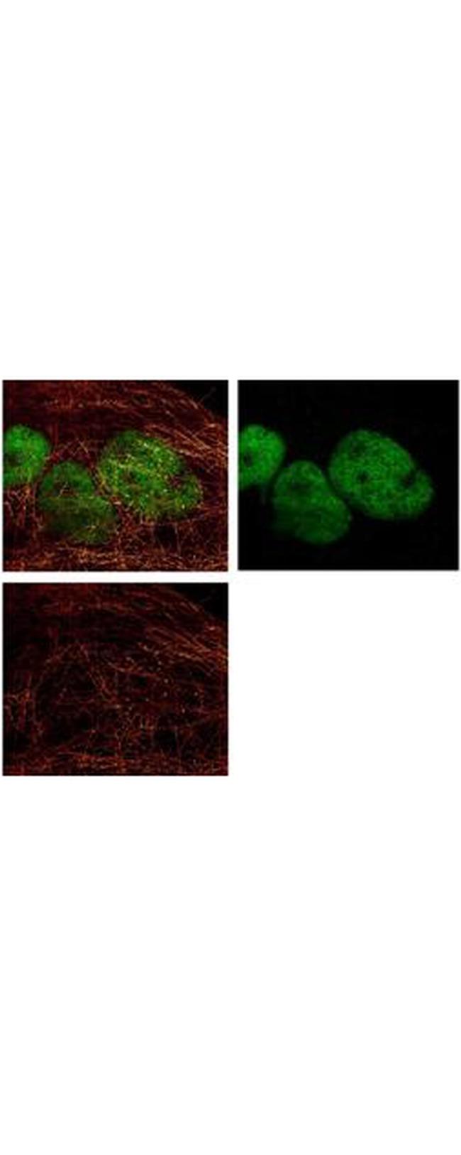 HDAC1 (C-terminus) Antibody in Immunocytochemistry (ICC/IF)