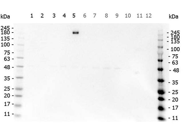 EGFR Antibody in Western Blot (WB)