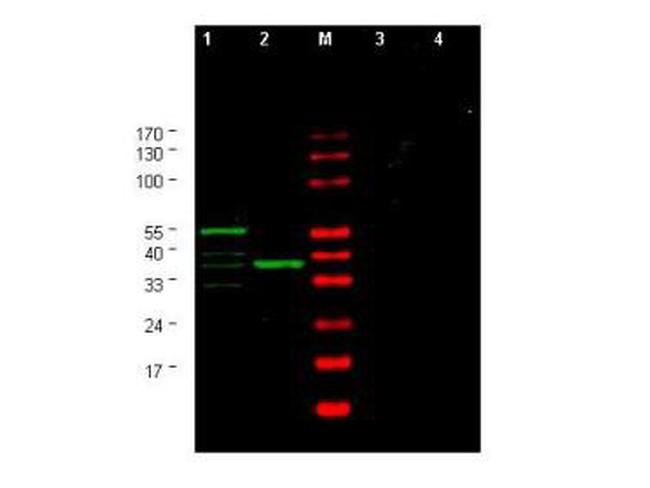 CHK1 Antibody in Western Blot (WB)