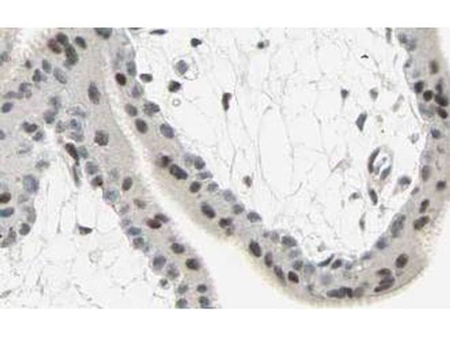 SMAD3 Antibody in Immunohistochemistry (Paraffin) (IHC (P))