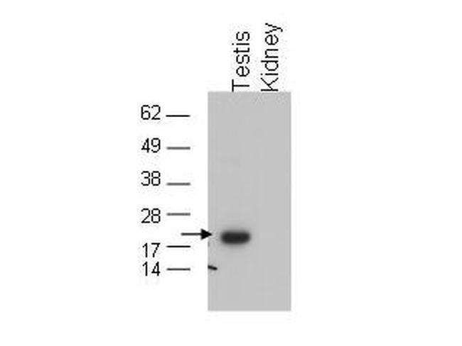 Glutathione Peroxidase 4 Antibody in Western Blot (WB)