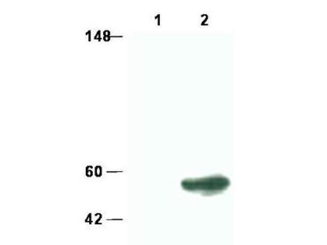 SMAD3 Antibody in Western Blot (WB)