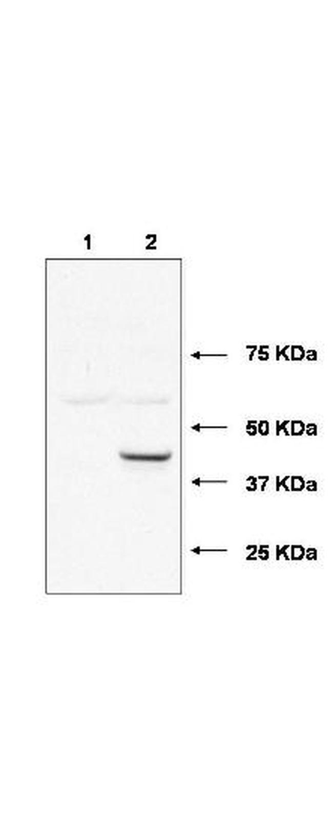 UBE2J1 Antibody in Western Blot (WB)