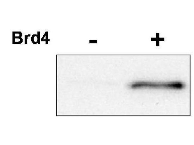 Phospho-CDK9 (Thr29) Antibody in Western Blot (WB)