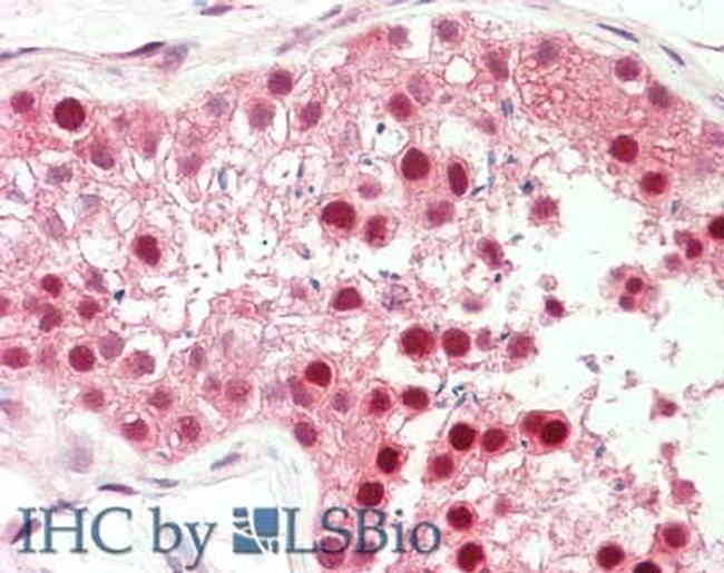 PIN1 Antibody in Immunohistochemistry (Paraffin) (IHC (P))