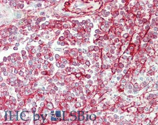 NCOA3 Antibody in Immunohistochemistry (Paraffin) (IHC (P))