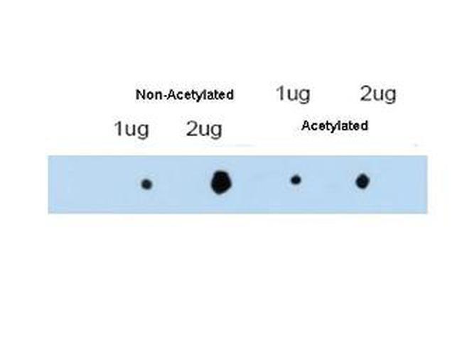 ATDC Antibody in Dot Blot (DB)