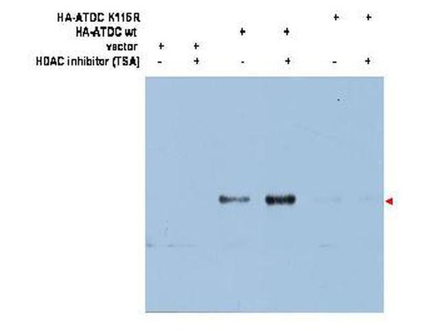 ATDC Ac-K116 Antibody in Western Blot (WB)