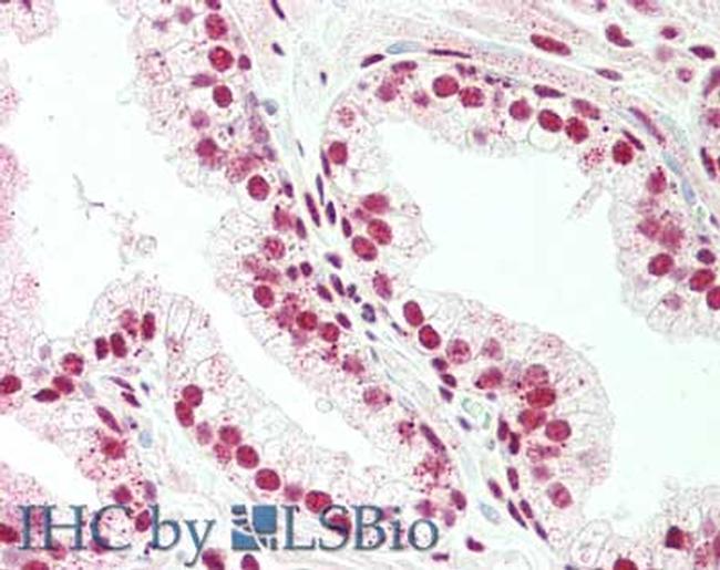 PRDM1 BLIMP1 Antibody in Immunohistochemistry (Paraffin) (IHC (P))