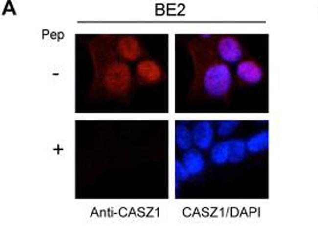 CASZ1 Antibody in Immunocytochemistry (ICC/IF)