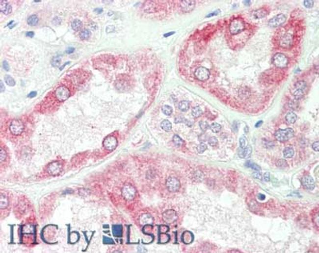 Sprouty-2 Antibody in Immunohistochemistry (Paraffin) (IHC (P))