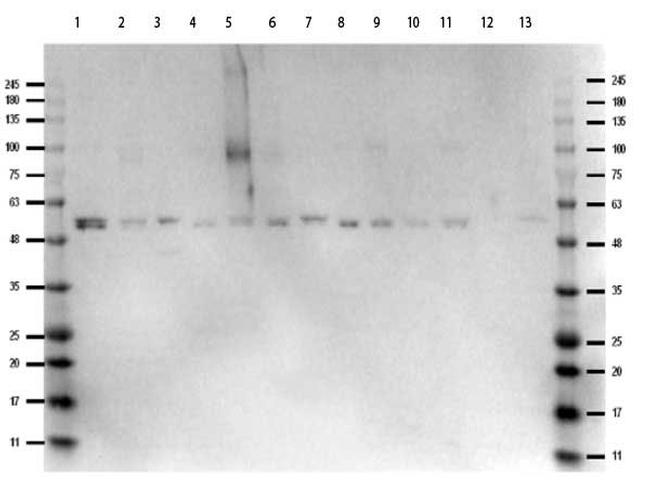 ERK2 Internal Antibody in Western Blot (WB)