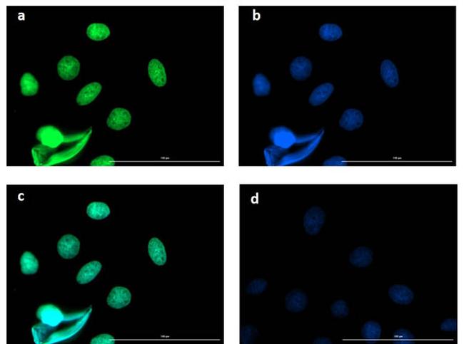 BCL3 Antibody in Immunocytochemistry (ICC/IF)