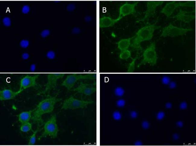 PINK1 truncated Antibody in Immunocytochemistry (ICC/IF)