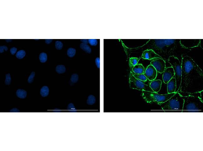 ZO-1 Antibody in Immunocytochemistry (ICC/IF)