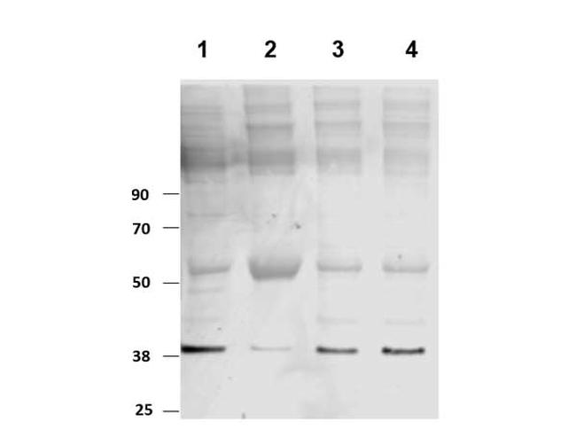 PKM2 Antibody in Western Blot (WB)