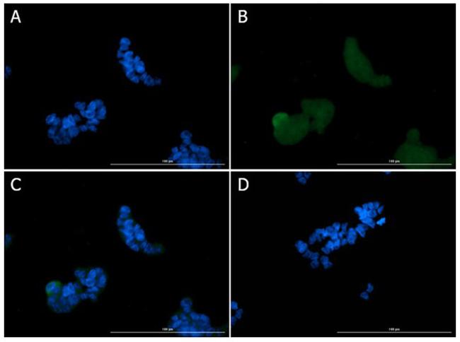 Ire1 Antibody in Immunocytochemistry (ICC/IF)