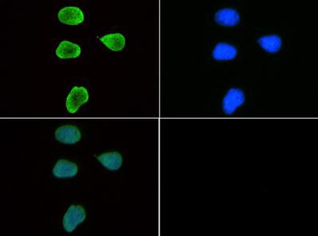 H3K9me3 Antibody in Immunocytochemistry (ICC/IF)