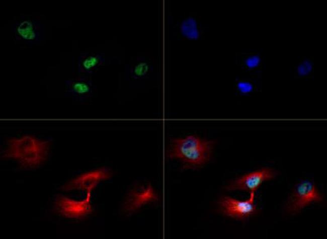 H3K79me3 Antibody in Immunocytochemistry (ICC/IF)