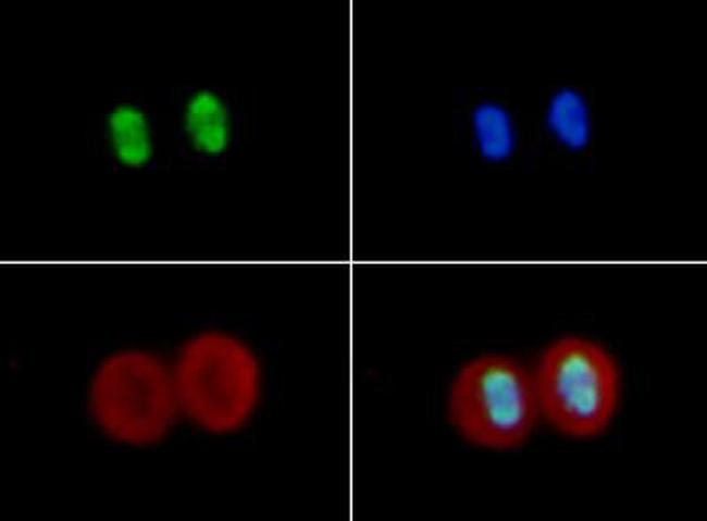 H4K16ac Antibody in Immunocytochemistry (ICC/IF)